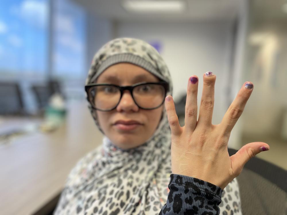 Nova Jaswan lost the tip of her middle finger when a cell door at Fulton County Jail closed on her hand.
Credit: Ellen Eldridge/GPB News